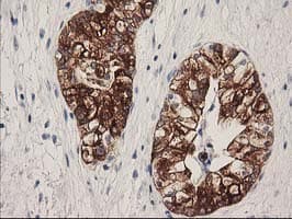 ATP6V1B1 Antibody (clone OTI1H6)