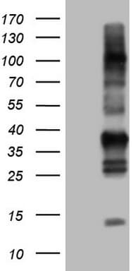 TACC2 Antibody (aa727-1026, clone OTI8D11)