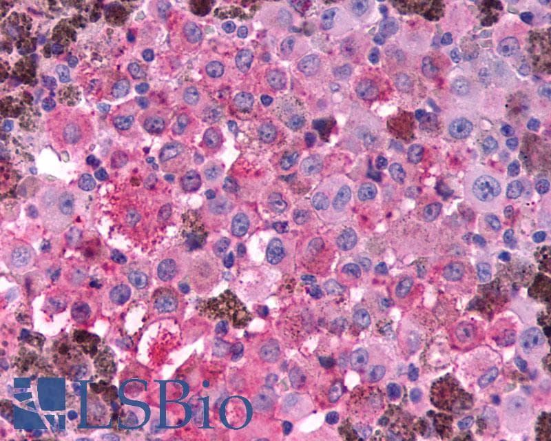 PathPlus™ Polyclonal Rabbit anti-Human GLP1R / GLP-1 Receptor Antibody (N-Terminus, IHC)