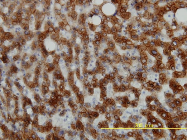 KRT18 / CK18 / Cytokeratin 18 Antibody (clone 2F8)