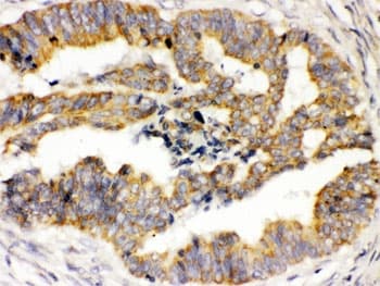 Polyclonal Rabbit anti-Human TRPM4 Antibody (IHC, WB)