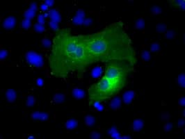 Monoclonal Mouse anti-Human ACSBG1 / hsBG Antibody (clone OTI1D8, IHC, IF, WB)
