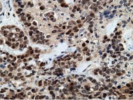 EPM2AIP1 Antibody (clone OTI2G3)
