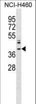 ZNF75A Antibody (aa98-124)