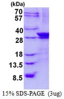 Human LIN7A Protein (Recombinant His)