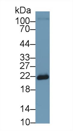 SOD2 / Mn SOD Antibody (aa25-222)