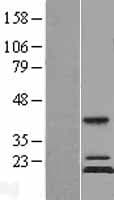 MRPS11 Protein (Over-Expression Lysate Myc-DDK (Flag))
