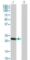 Polyclonal Rabbit anti-Human RGS5 Antibody (aa169-181, WB)