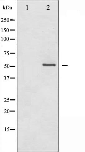 HDAC2 Antibody (phospho-Ser394)