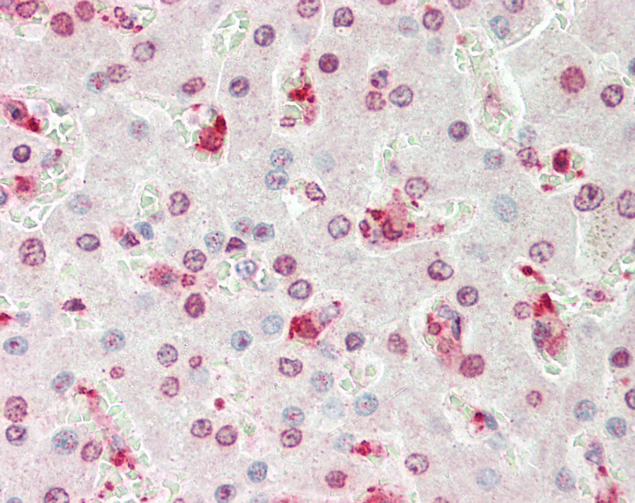 PLA2G4B Antibody (aa651-700)