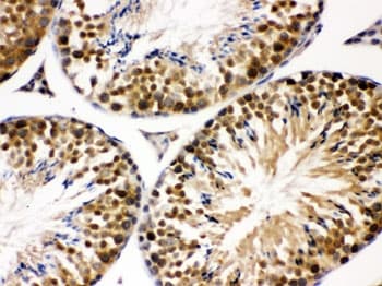 Polyclonal Rabbit anti-Human COPS5 / JAB1 Antibody (IHC, WB)