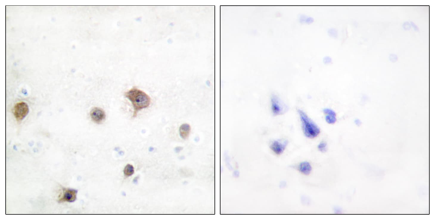 MAPK8IP2 / JIP2 Antibody (aa581-630)