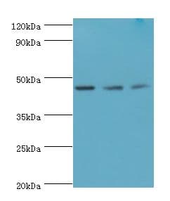Polyclonal Rabbit anti-Human ACY1 / Aminoacylase 1 Antibody (aa1-408, IHC, WB)