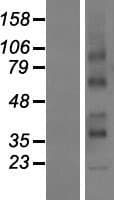 RCE1 Protein (Over-Expression Lysate Myc-DDK (Flag))