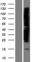 FAK / Focal Adhesion Kinase Protein (Over-Expression Lysate Myc-DDK (Flag))