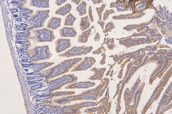 Polyclonal Rabbit anti-Human SFRP1 Antibody (IHC, WB)
