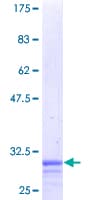 Human ZC3HC1 / NIPA Protein (Recombinant GST)