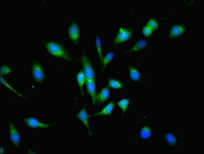 Polyclonal Rabbit anti-Human POGK Antibody