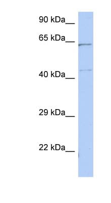 EME1 Antibody (C-Terminus)