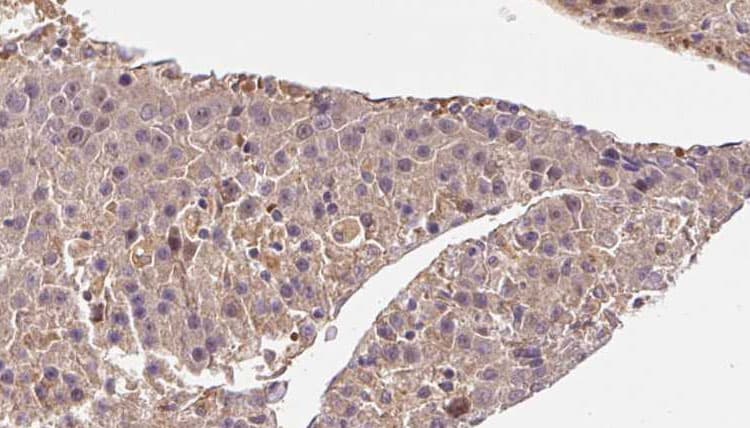ARL13B Antibody