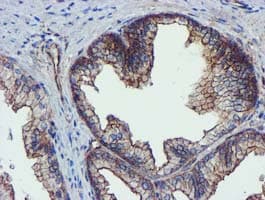 EPN2 Antibody (clone OTI1F1)