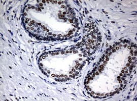 NBN / Nibrin Antibody (clone OTI3A9)