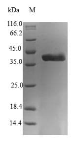 Human PEA15 / PEA-15 Protein (Recombinant GST, N-terminus)