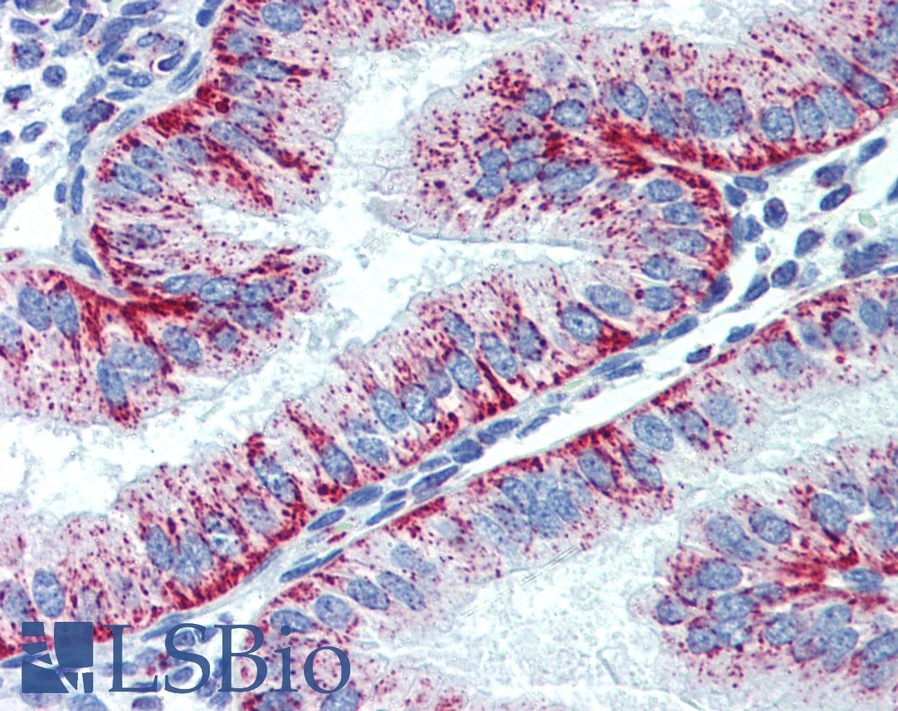 PathPlus™ HSPD1 / HSP60 Antibody (clone LK-2)