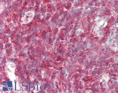 PFN1 / Profilin 1 Antibody (N-Terminus)