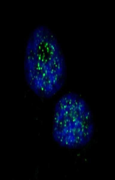 CHEK1 / CHK1 Antibody (aa250-300)