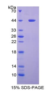 Human LACRT Protein (Recombinant His-GST)