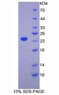 Chicken HBB / Hemoglobin Beta Protein (Recombinant His-S)
