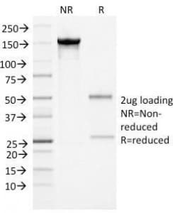 Monoclonal Mouse anti-Human Alpha-1-Antichymotrypsin Antibody (clone AACT/1452, Azide-free,BSA-free, IHC, IF, WB)