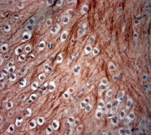 NEFH / NF-H Antibody (aa150-200)