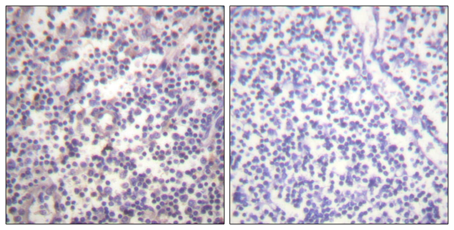 Polyclonal Rabbit anti-Human BRAF / B-Raf Antibody (phospho-Ser602, IHC, WB)