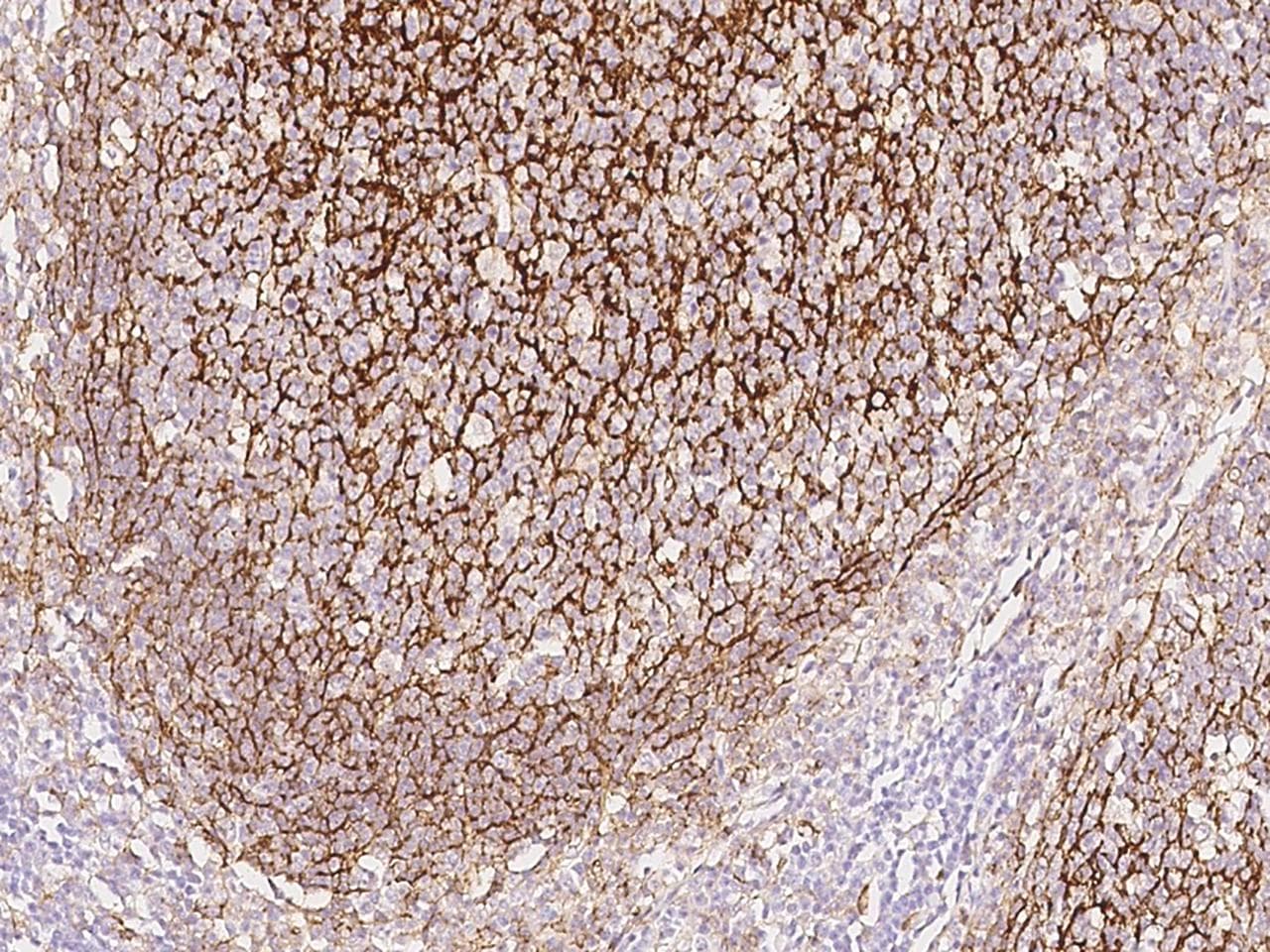 Polyclonal Rabbit anti-Human CR1 / CD35 Antibody (IHC)