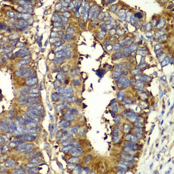 Polyclonal Rabbit anti-Human GLNRS / QARS Antibody (IHC, IF, WB)