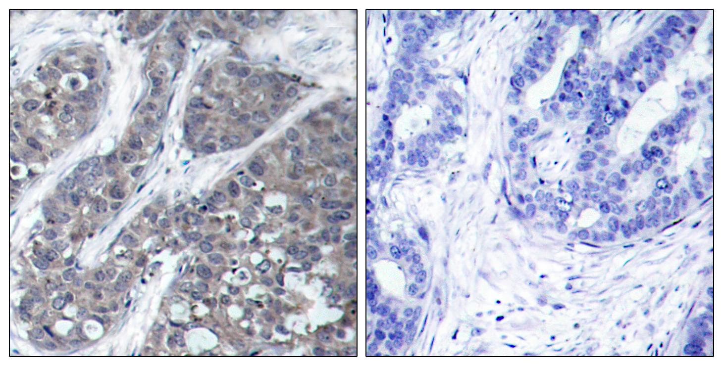 Polyclonal Rabbit anti-Human PTK2B / PYK2 Antibody (p402, IHC)
