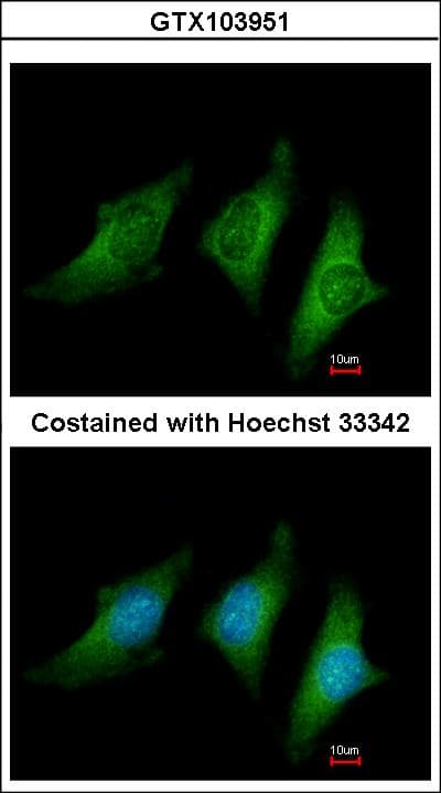 IHC-plus™ CD55 Antibody (aa71-330)