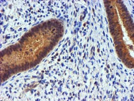 PDSS2 / DLP1 Antibody (clone OTI1D10)