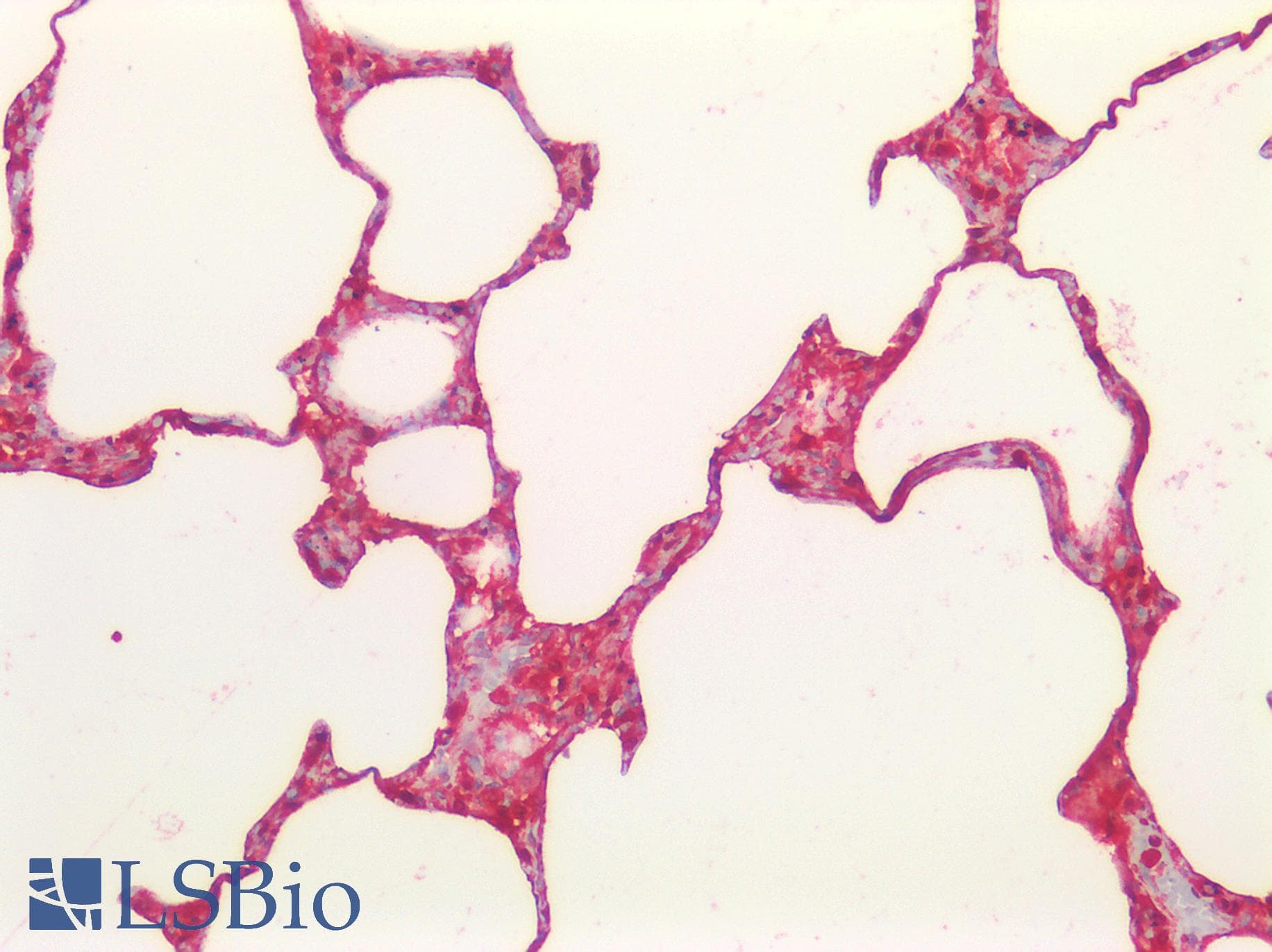Polyclonal Rabbit anti-Human S100A6 / Calcyclin Antibody (aa1-90, IHC, WB)