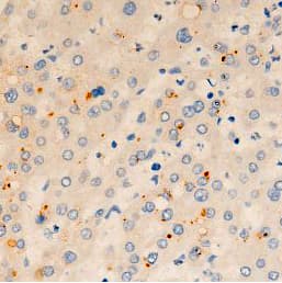 Polyclonal Rabbit anti-Human TMEM142A / ORAI1 Antibody (IHC, WB)