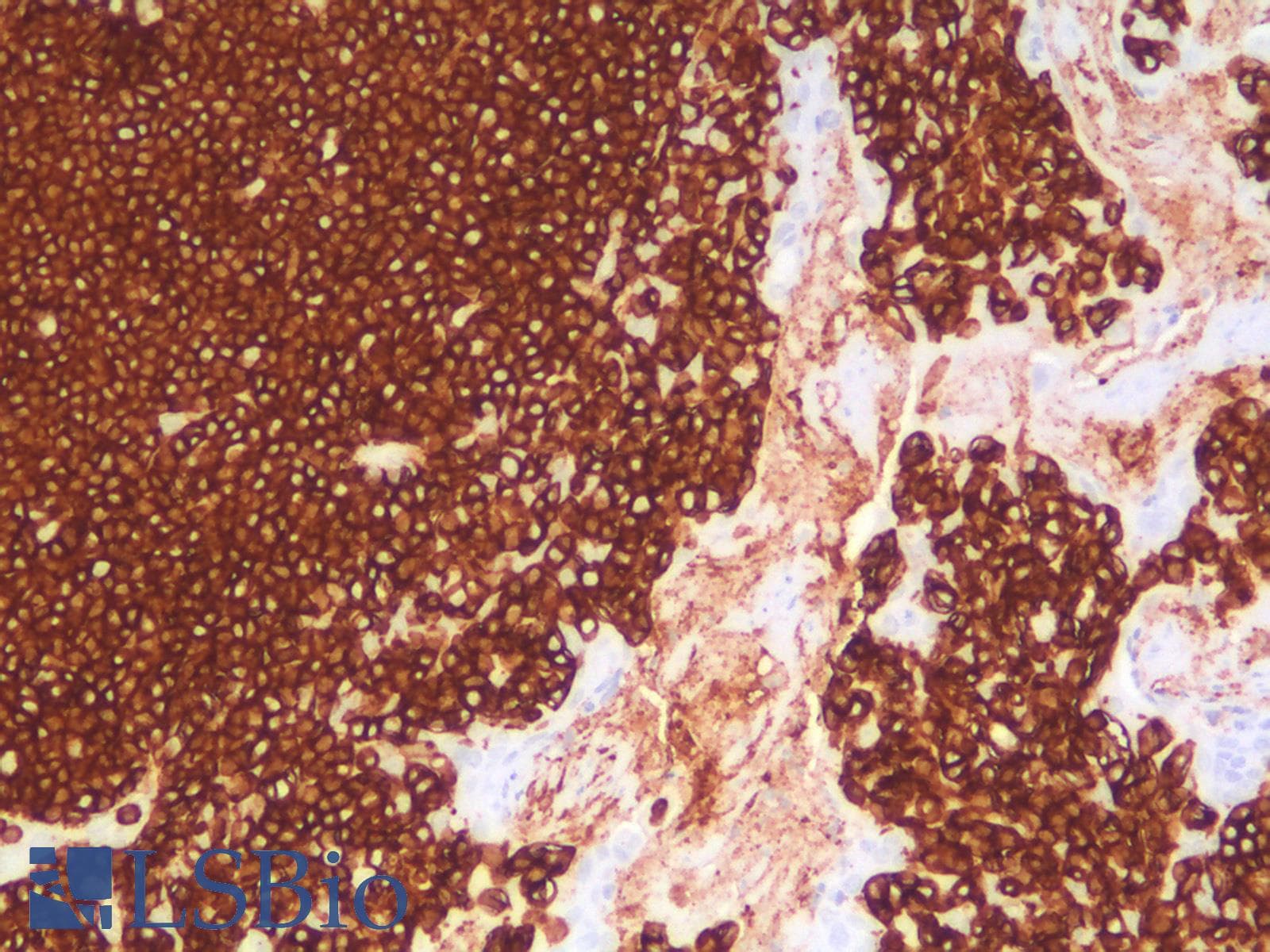 PathPlus™ CD45 / LCA Antibody (clone PTPRC/1783R)