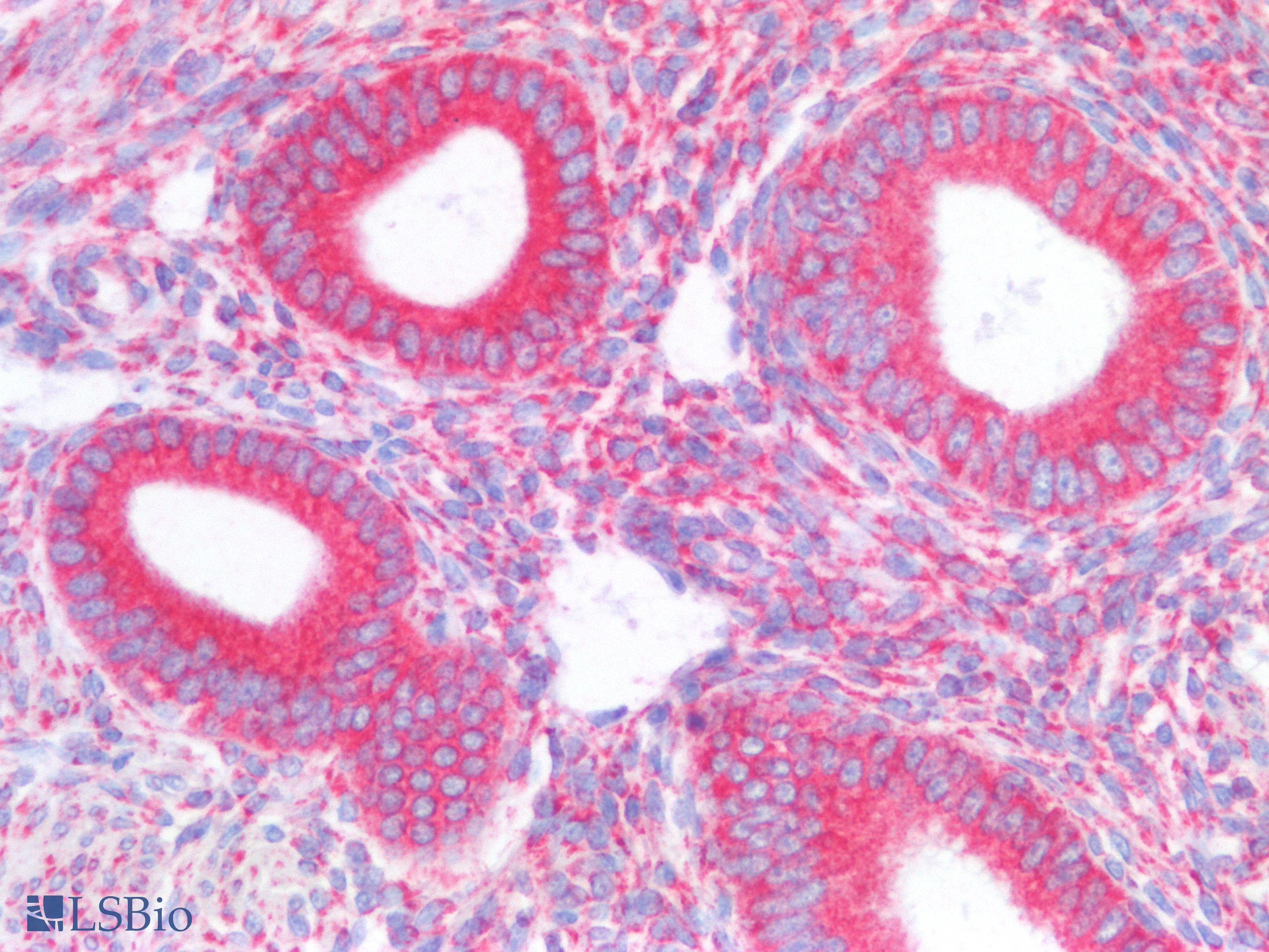 PathPlus™ MTDH / Metadherin Antibody (aa70-582, clone OTI1E7)