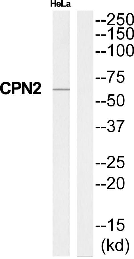 Polyclonal Rabbit anti-Human CPN2 Antibody (WB)