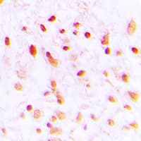 CTBP1 / CTBP Antibody (C-Terminus)
