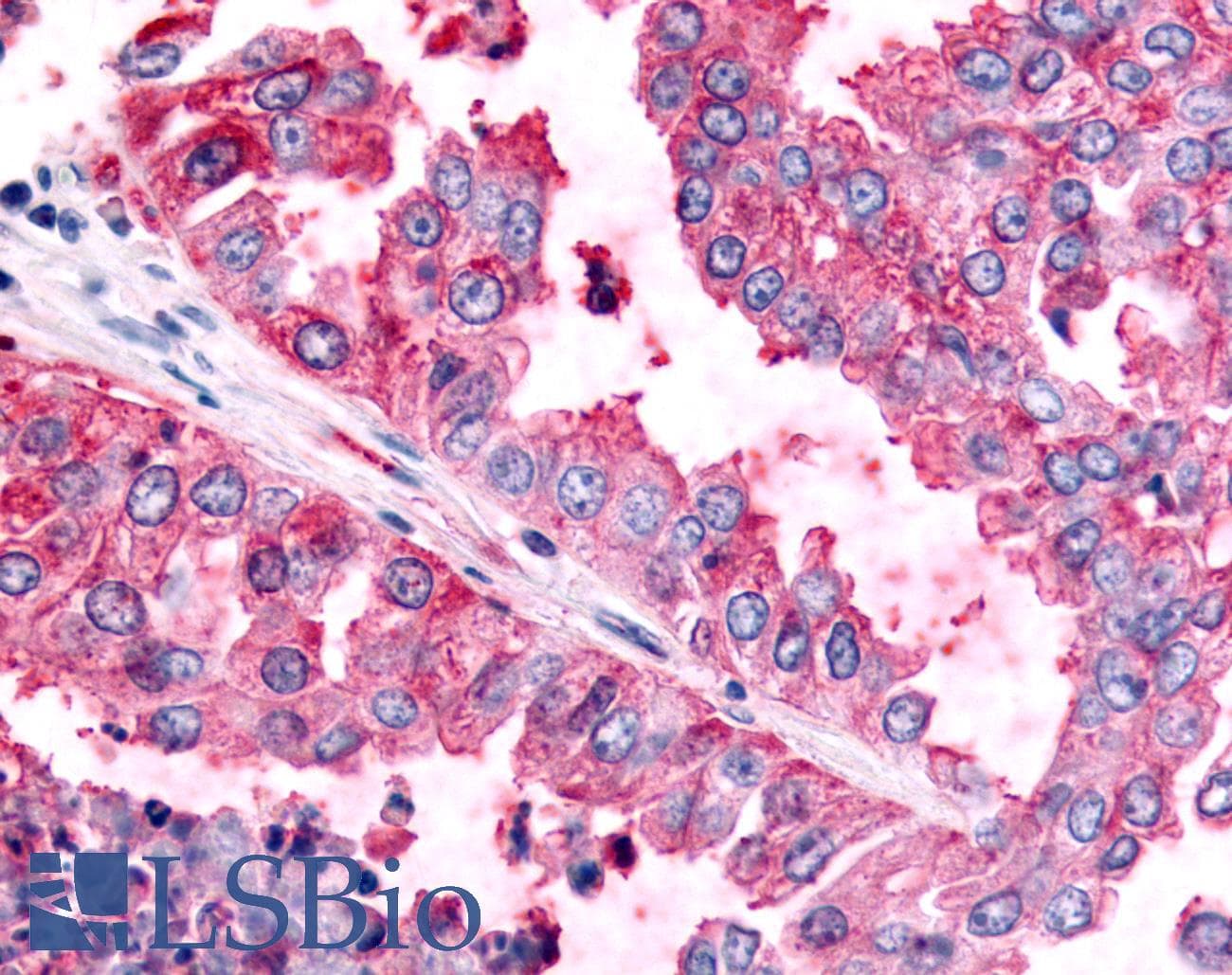 PathPlus™ PAK6 Antibody (Linker Domain)