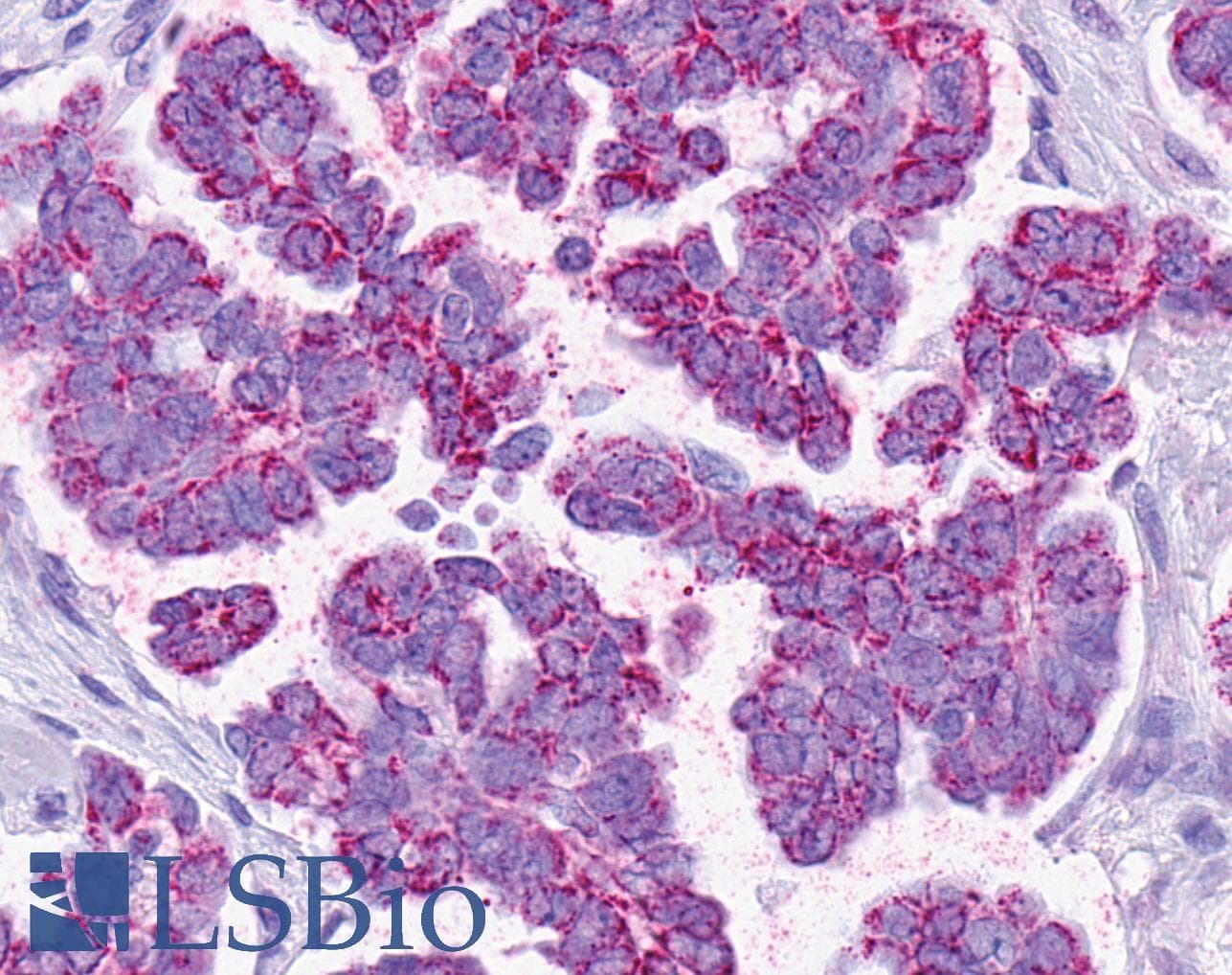 IHC-plus™ Polyclonal Rabbit anti-Human SMO / Smoothened Antibody (1st Extracellular Domain, IHC, IF)