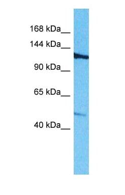Polyclonal Rabbit anti-Human ROBO3 Antibody (C-Terminus, WB)
