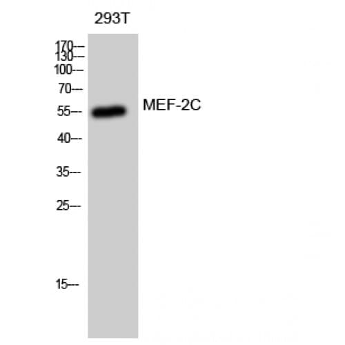 MEF2C Antibody (340-420 aa)